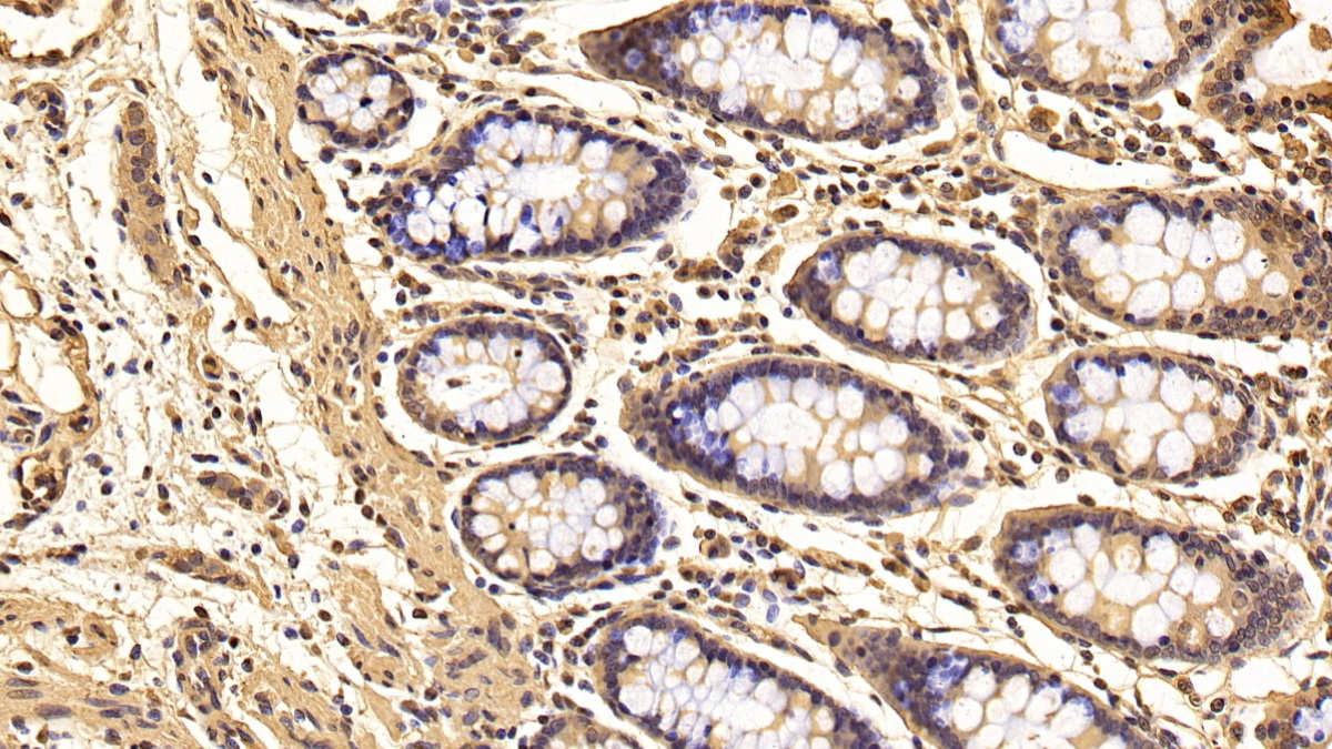 Monoclonal Antibody to Tyrosine 3/Tryptophan 5 Monooxygenase Activation Protein Zeta (YWHAz)