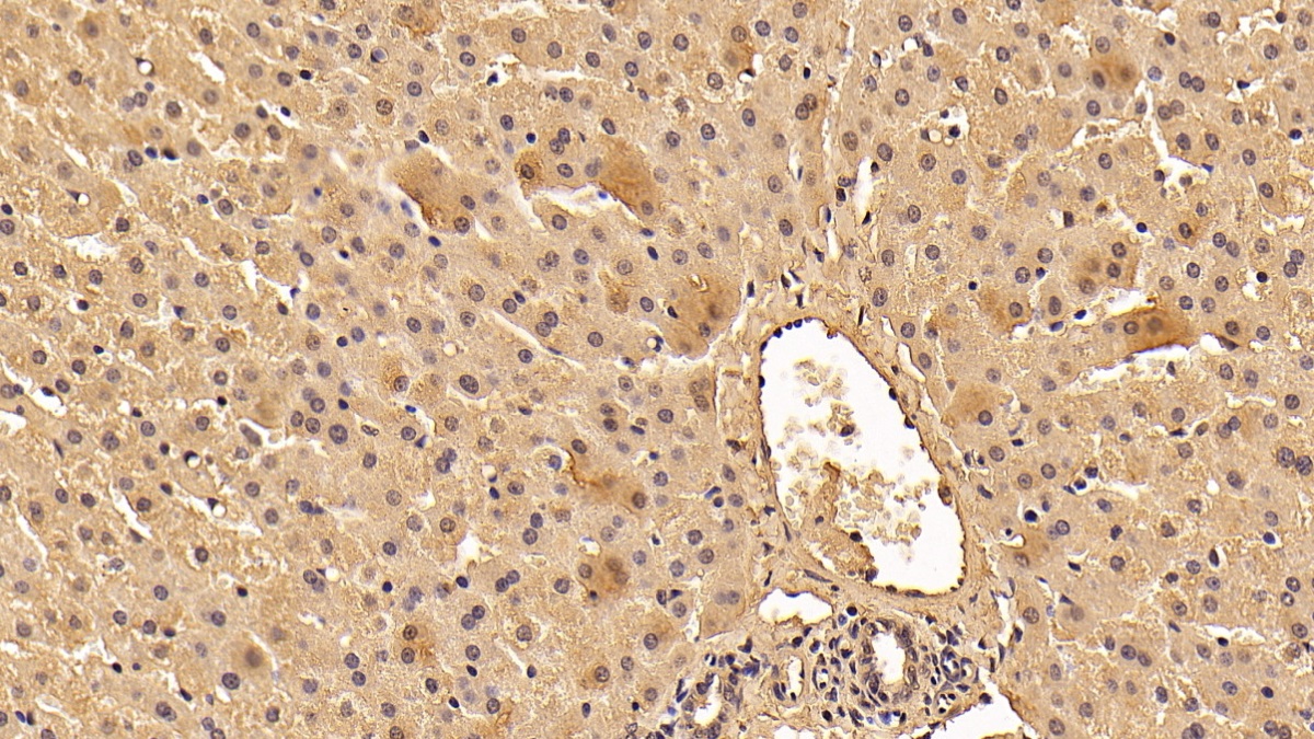 Monoclonal Antibody to Tyrosine 3/Tryptophan 5 Monooxygenase Activation Protein Zeta (YWHAz)