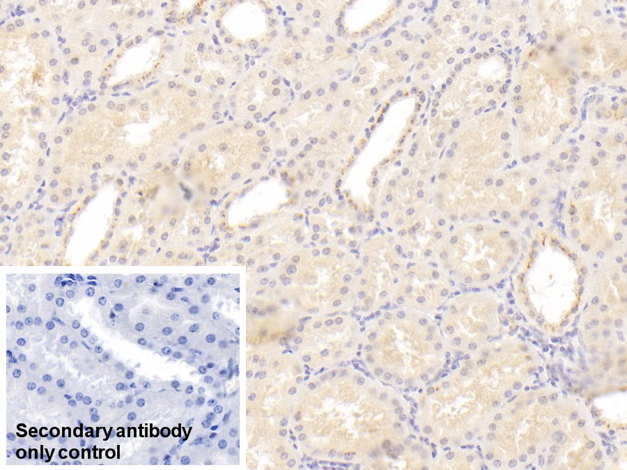 Monoclonal Antibody to C1q And Tumor Necrosis Factor Related Protein 1 (C1QTNF1)