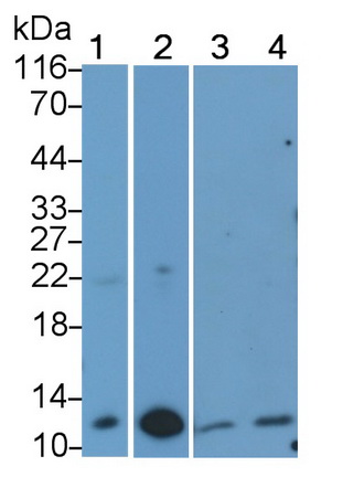 Monoclonal Antibody to Calprotectin (CALPRO)