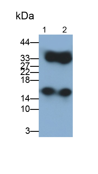 Monoclonal Antibody to Calprotectin (CALPRO)