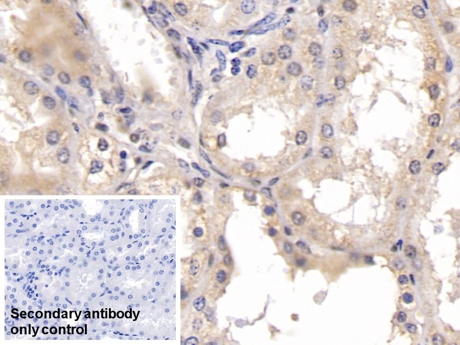 Monoclonal Antibody to Parkinson Disease Protein 7 (PARK7)