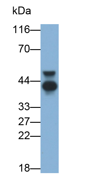 Monoclonal Antibody to Alpha-2-Glycoprotein 1, Zinc Binding (aZGP1)