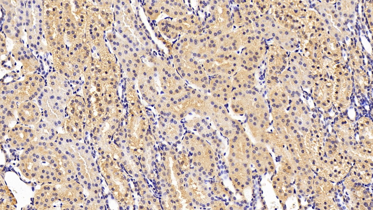 Monoclonal Antibody to Chaperonin Containing TCP1, Subunit 2 (CCT2)