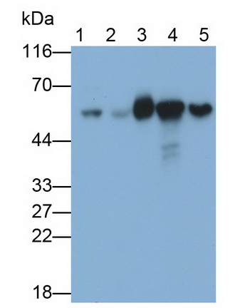 Monoclonal Antibody to Chaperonin Containing TCP1, Subunit 2 (CCT2)