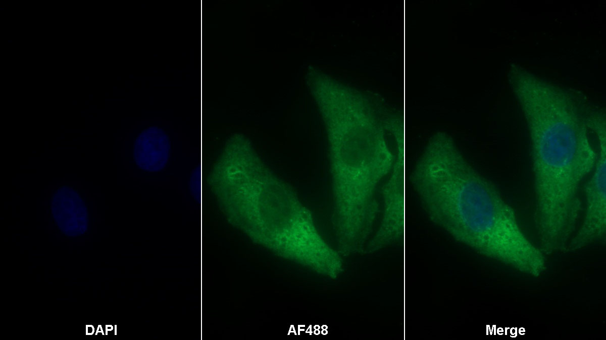 Monoclonal Antibody to Chaperonin Containing TCP1, Subunit 2 (CCT2)