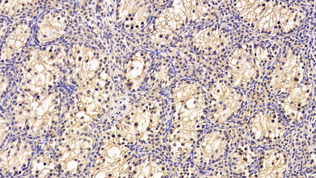 Monoclonal Antibody to Chaperonin Containing TCP1, Subunit 2 (CCT2)