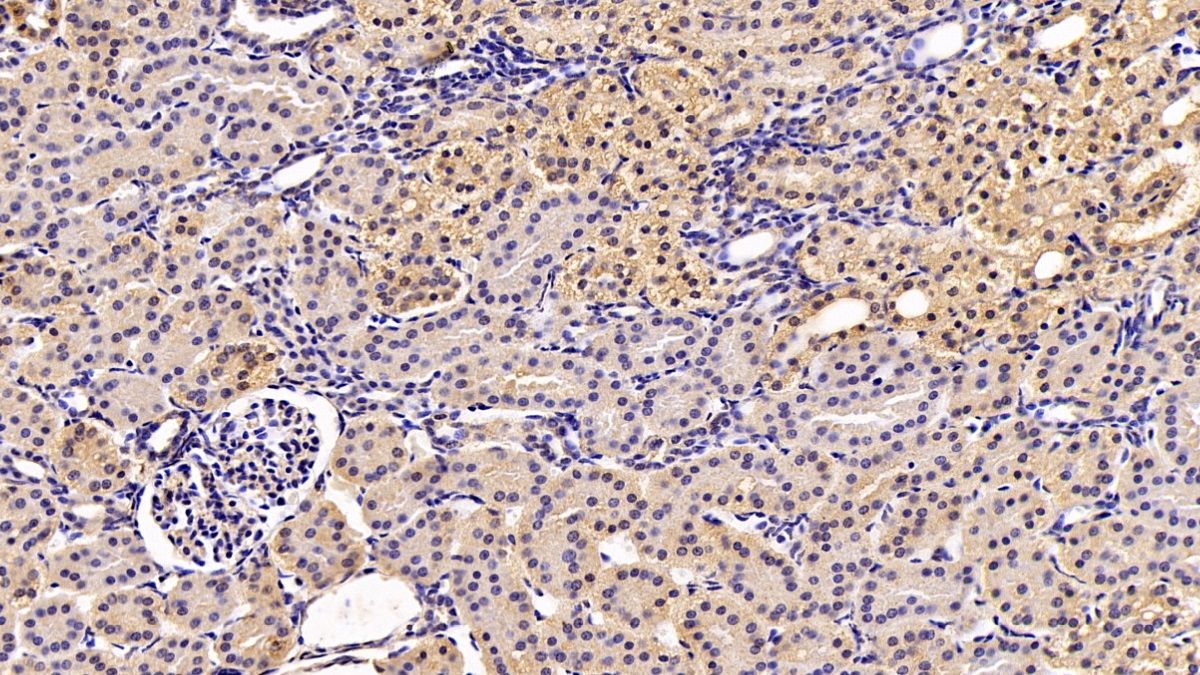 Monoclonal Antibody to Chaperonin Containing TCP1, Subunit 2 (CCT2)