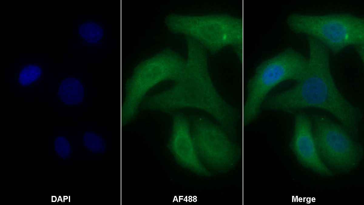 Monoclonal Antibody to Chaperonin Containing TCP1, Subunit 2 (CCT2)