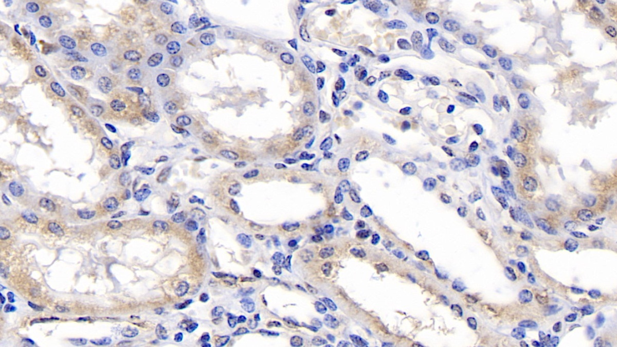 Monoclonal Antibody to Endoplasmic Reticulum Lipid Raft Associated Protein 2 (ERLIN2)