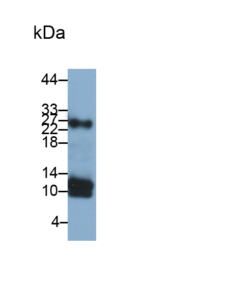 Monoclonal Antibody to Hypomagnesemia 2, Renal (HOMG2)