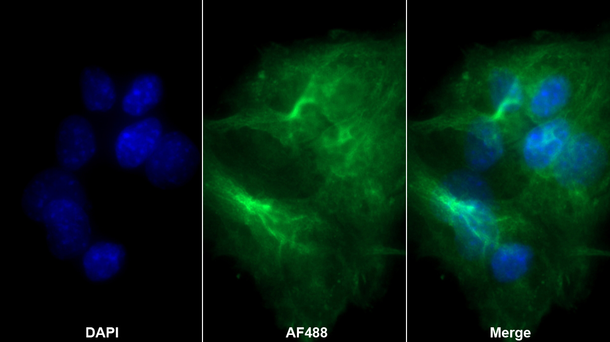 Monoclonal Antibody to Interleukin 1 Family, Member 9 (IL1F9)