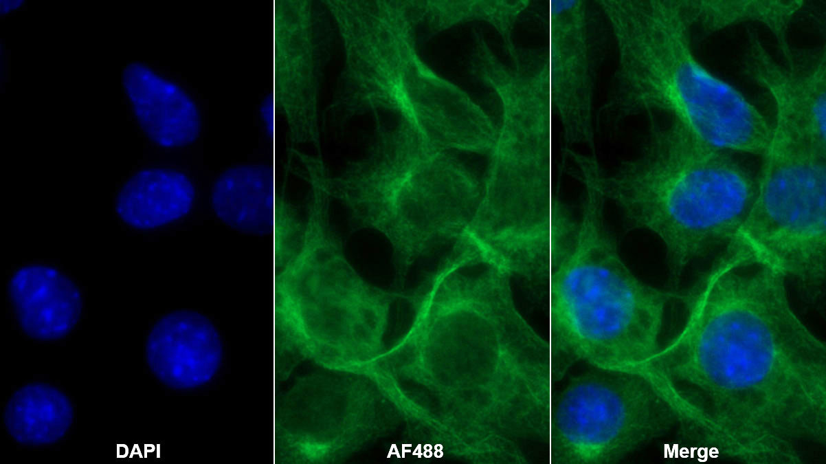 Monoclonal Antibody to Interleukin 1 Family, Member 9 (IL1F9)