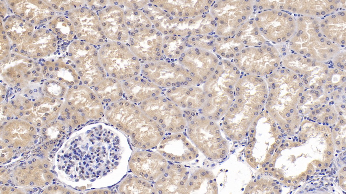 Monoclonal Antibody to Semaphorin 3A (SEMA3A)