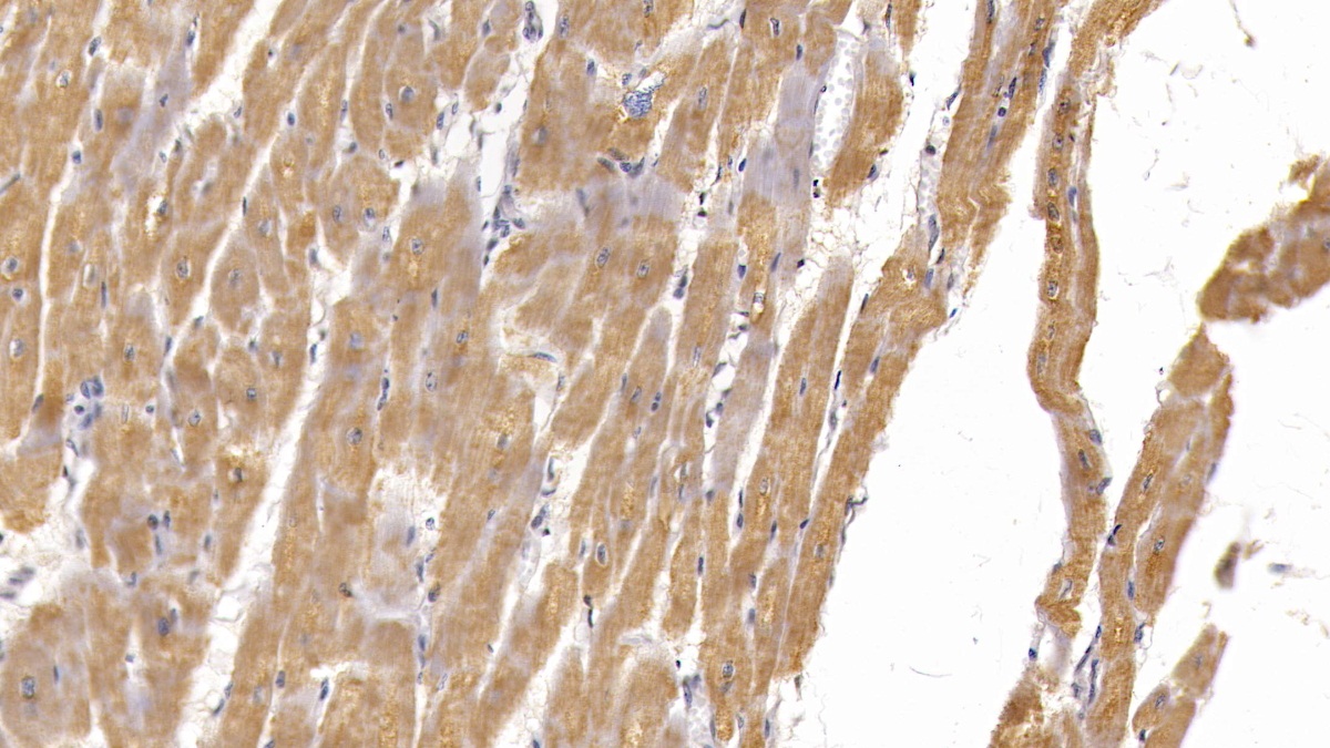 Monoclonal Antibody to Semaphorin 5B (SEMA5B)