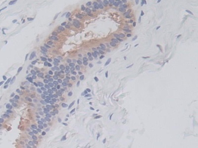 Monoclonal Antibody to V-Ral Simian Leukemia Viral Oncogene Homolog A (RALA)