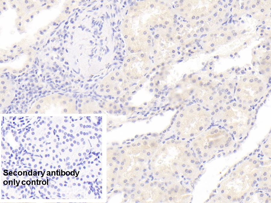 Monoclonal Antibody to Rh Blood Group, D Antigen (RHD)