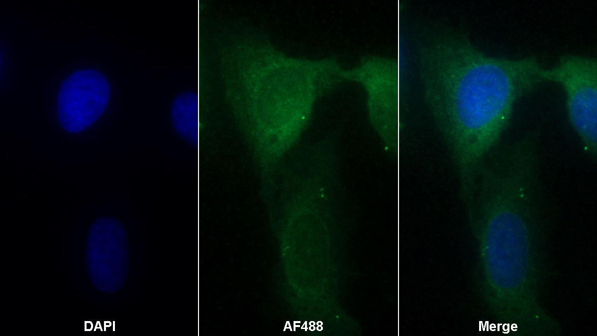 Monoclonal Antibody to Proteasome 26S Subunit, Non ATPase 10 (PSMD10)