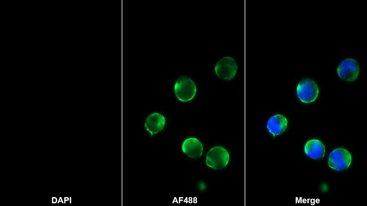 Monoclonal Antibody to Cluster Of Differentiation 8b (CD8b)