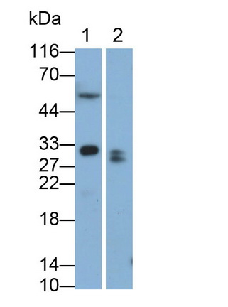 Monoclonal Antibody to Ependymin Related Protein 1 (EPDR1)