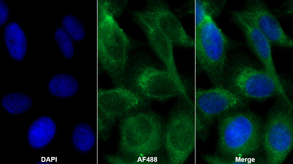 Monoclonal Antibody to CUB And Zona Pellucida Like Domains Protein 1 (CUZD1)