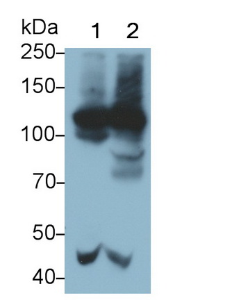 Monoclonal Antibody to Complement Component 4d (C4d)