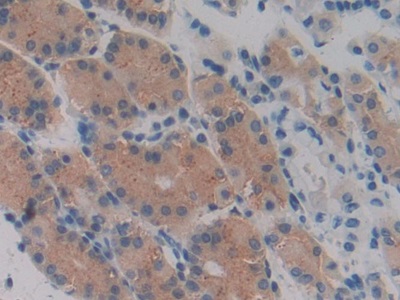 Monoclonal Antibody to Vascular Endothelial Growth Factor 145 (VEGF145)