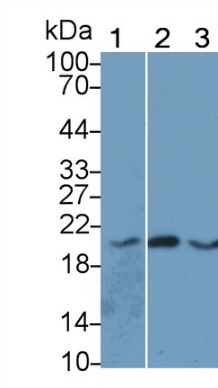 Monoclonal Antibody to Angiopoietin Like Protein 8 (ANGPTL8)