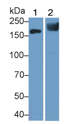 Polyclonal Antibody to Angiotensin I Converting Enzyme (ACE)