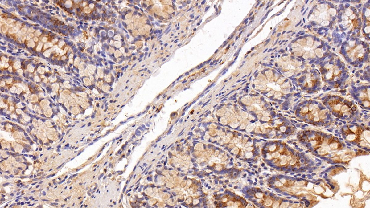 Polyclonal Antibody to Angiogenin (ANG)