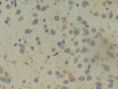 Polyclonal Antibody to Angiogenin (ANG)