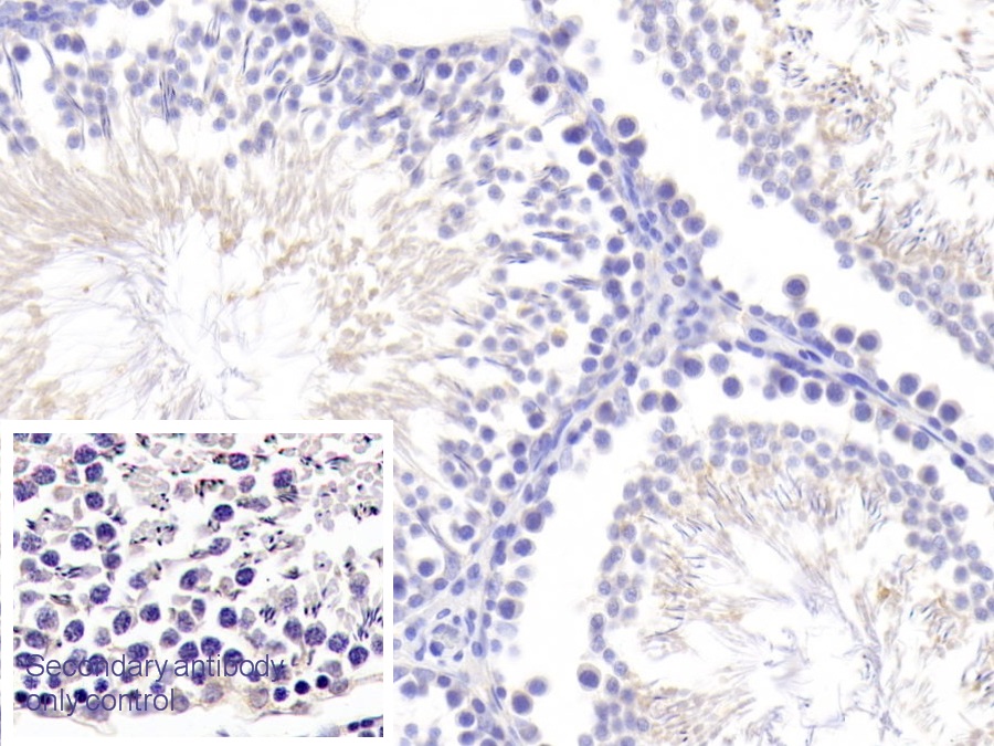 Polyclonal Antibody to Angiogenin (ANG)