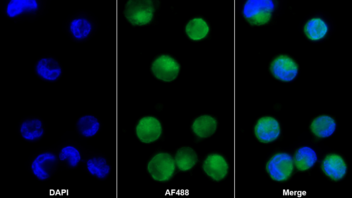 Polyclonal Antibody to Angiopoietin 1 (ANGPT1)