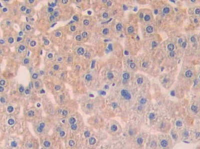 Polyclonal Antibody to Angiopoietin 1 (ANGPT1)