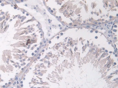 Polyclonal Antibody to Angiopoietin 1 (ANGPT1)