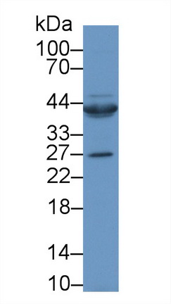 Polyclonal Antibody to Connective Tissue Growth Factor (CTGF)