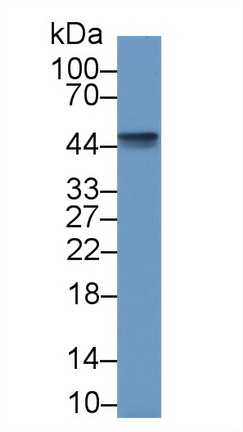 Polyclonal Antibody to Connective Tissue Growth Factor (CTGF)