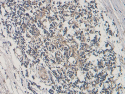 Polyclonal Antibody to Connective Tissue Growth Factor (CTGF)