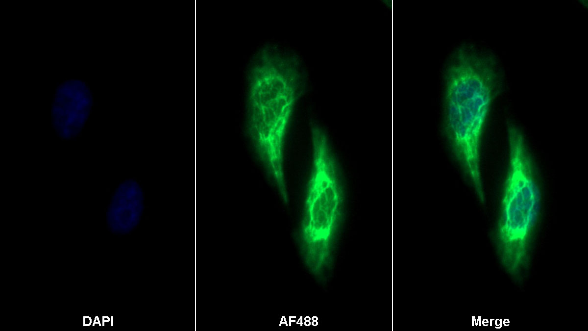 Polyclonal Antibody to Connective Tissue Growth Factor (CTGF)