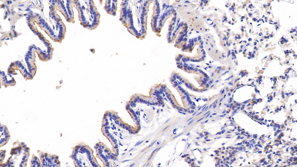 Polyclonal Antibody to Connective Tissue Growth Factor (CTGF)