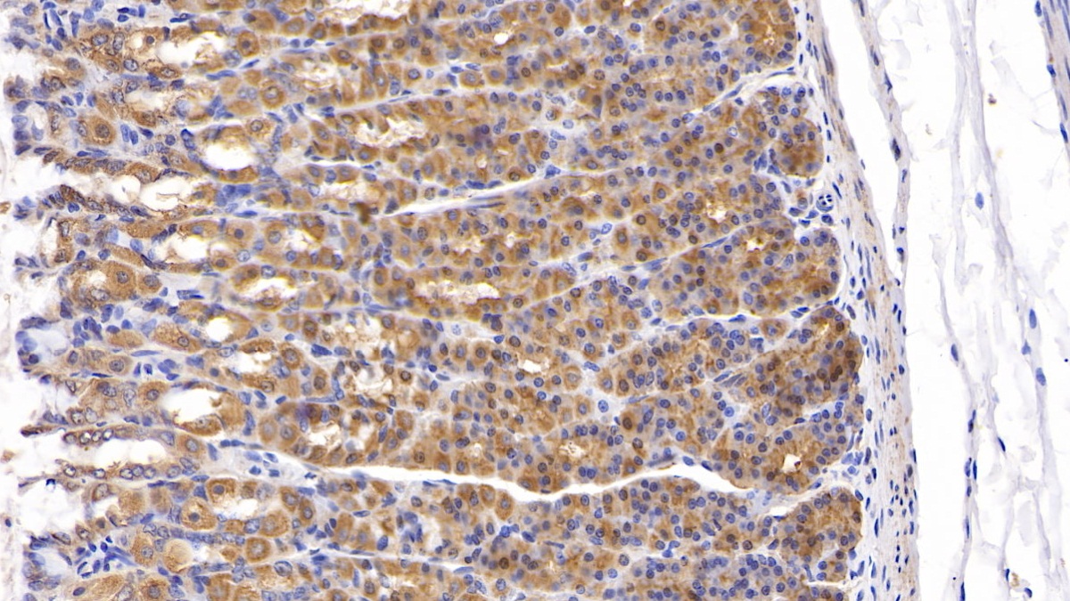 Polyclonal Antibody to Connective Tissue Growth Factor (CTGF)