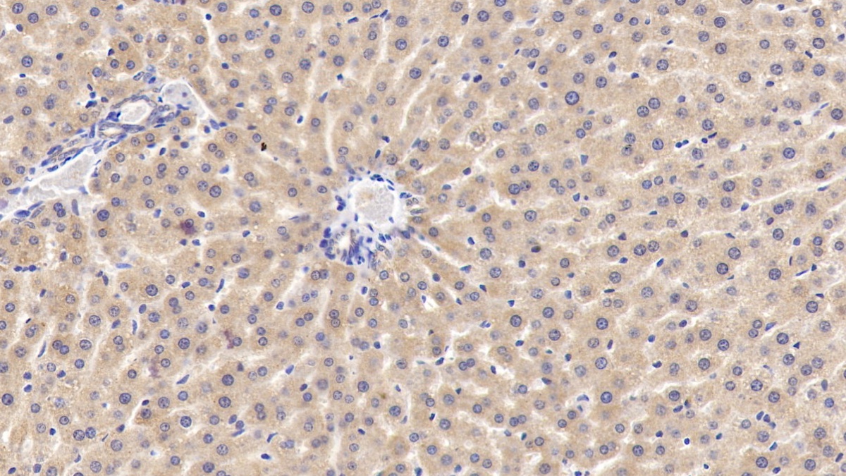 Polyclonal Antibody to Connective Tissue Growth Factor (CTGF)