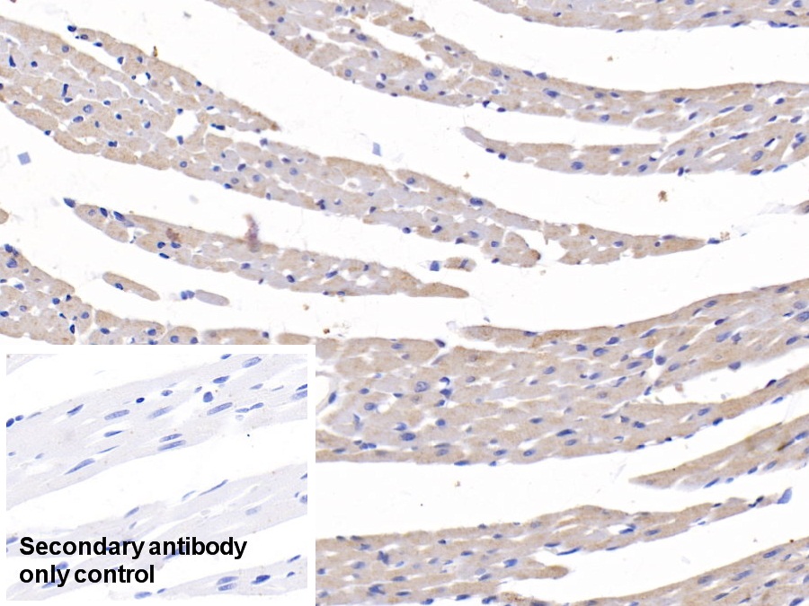 Polyclonal Antibody to Connective Tissue Growth Factor (CTGF)