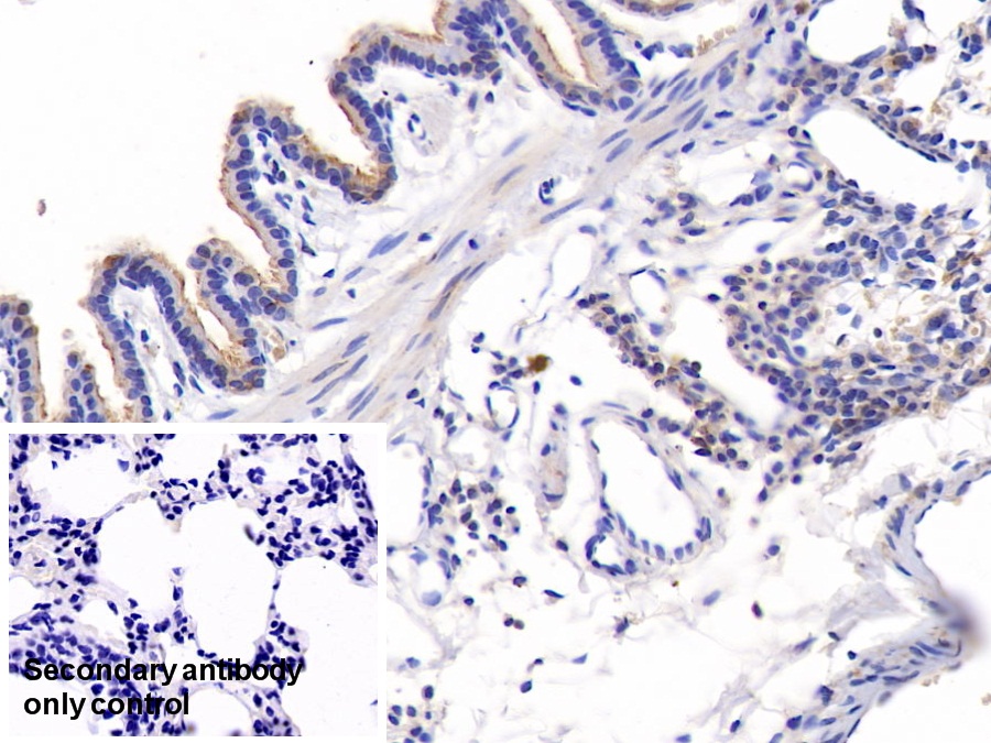 Polyclonal Antibody to Connective Tissue Growth Factor (CTGF)