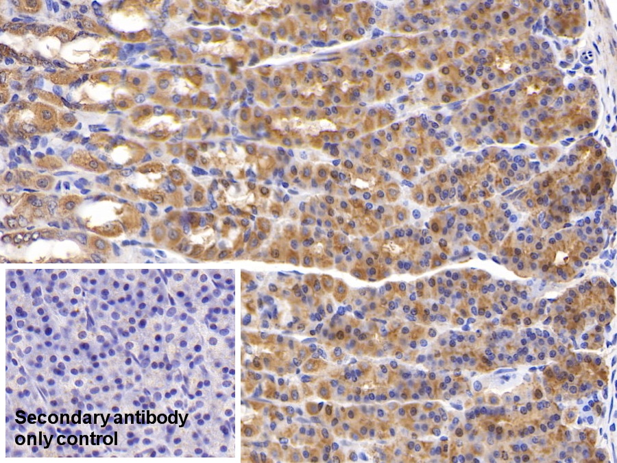 Polyclonal Antibody to Connective Tissue Growth Factor (CTGF)