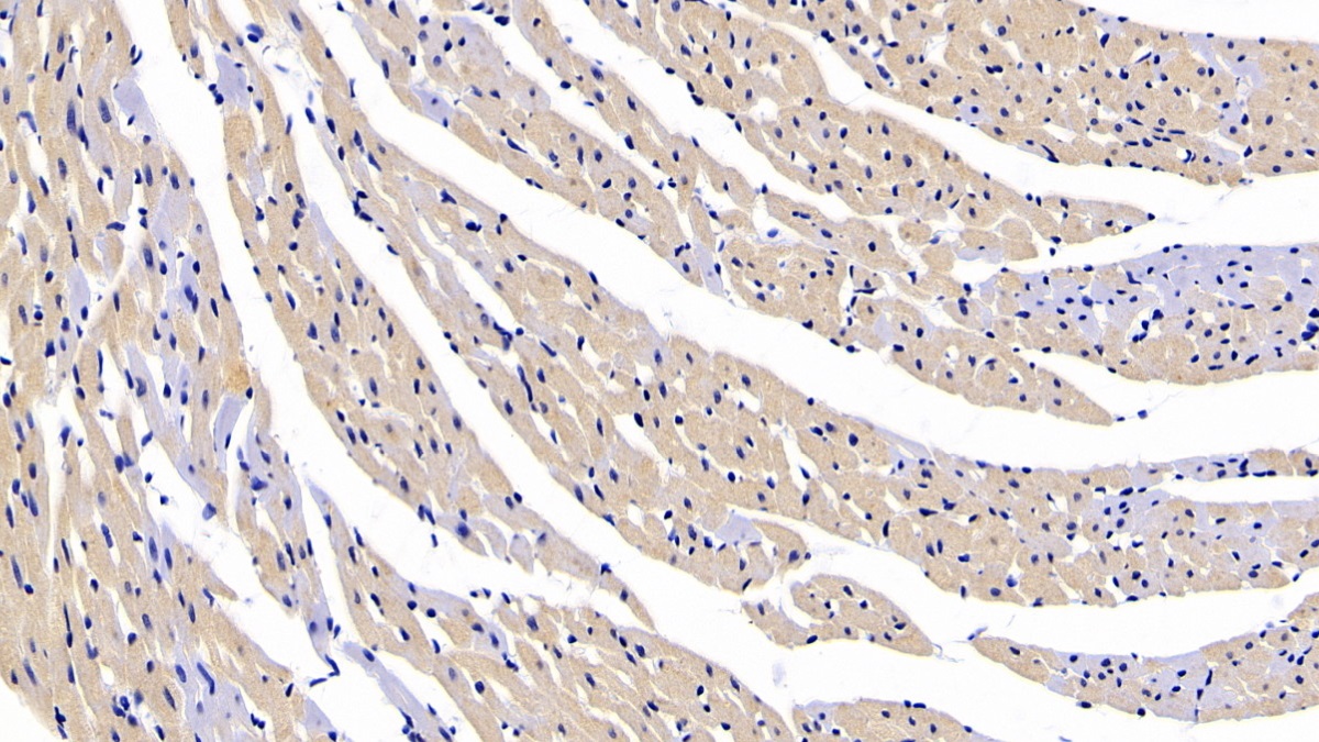 Polyclonal Antibody to Connective Tissue Growth Factor (CTGF)