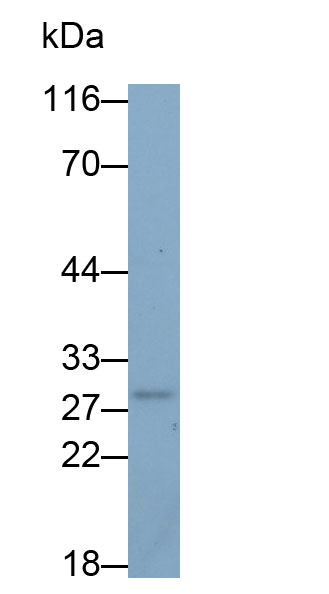 Polyclonal Antibody to Brain Derived Neurotrophic Factor (BDNF)