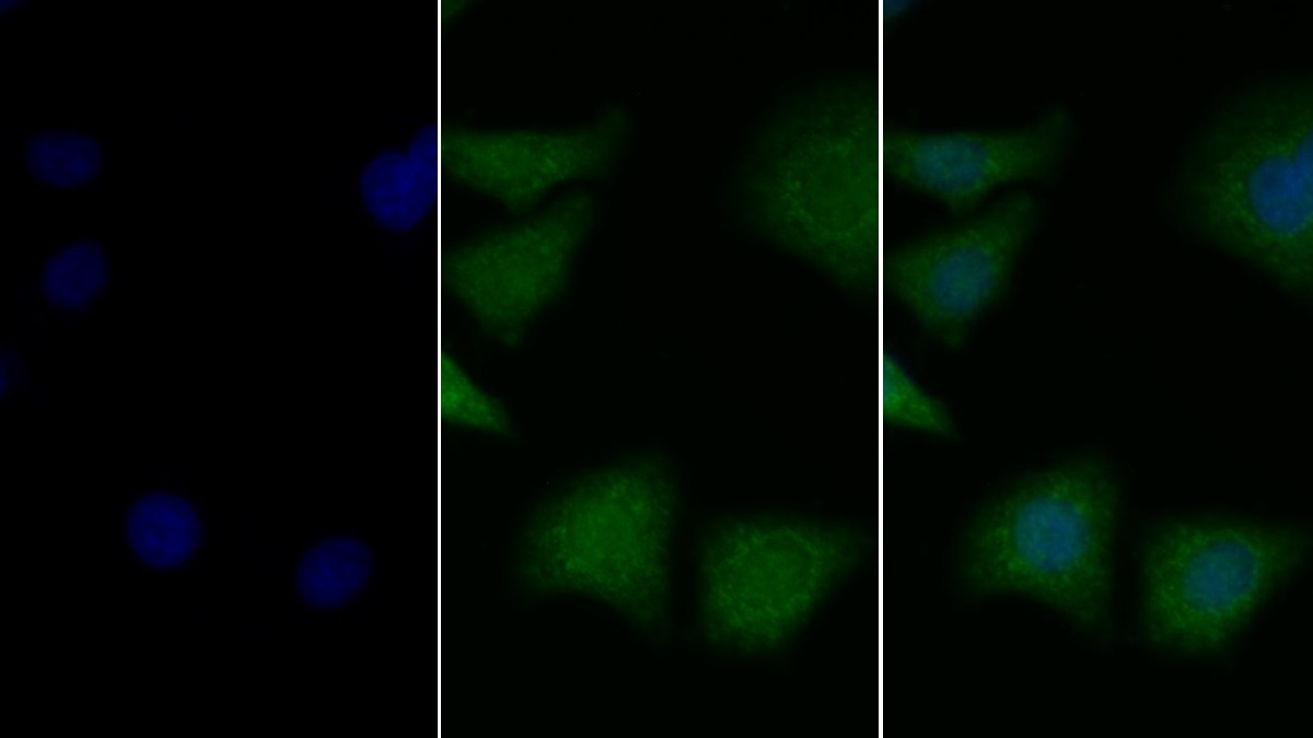 Polyclonal Antibody to Brain Derived Neurotrophic Factor (BDNF)