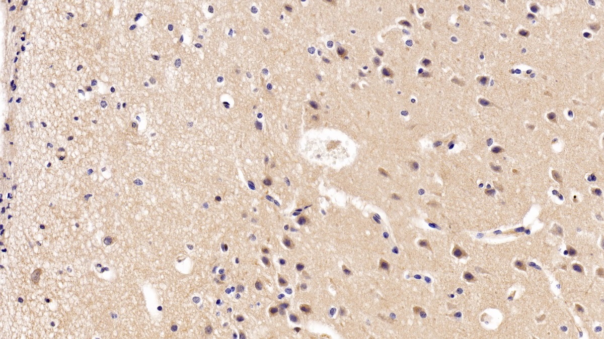 Polyclonal Antibody to Brain Derived Neurotrophic Factor (BDNF)