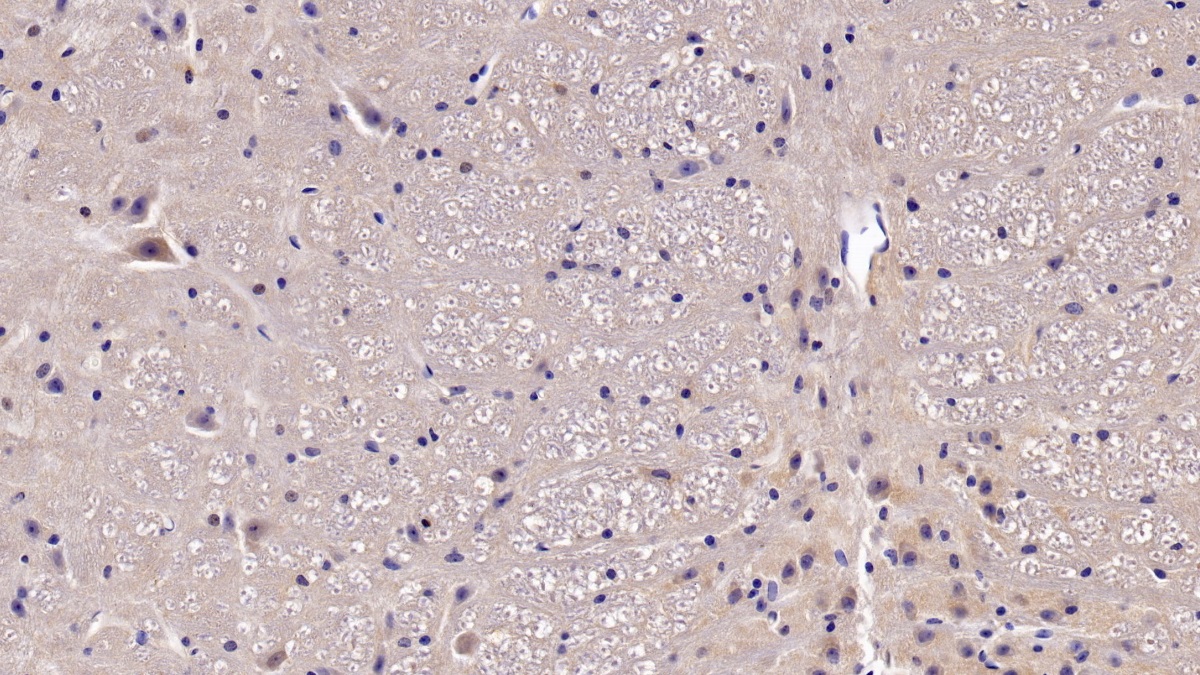 Polyclonal Antibody to Brain Derived Neurotrophic Factor (BDNF)